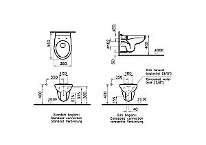 Унитаз подвесной Vitra Normus 9773B003-7206 с инсталляцией, с крышкой микролифт, белый купить в интернет-магазине Sanbest