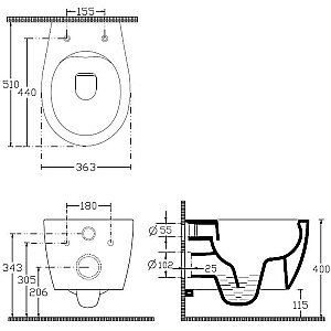 Унитаз Allen Brau Fantasy 4.11004.SM безободковый, розовый купить в интернет-магазине Sanbest