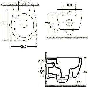 Унитаз Allen Brau Fantasy 4.11HC1.20 безободковый, с крышкой микролифт, белый купить в интернет-магазине Sanbest