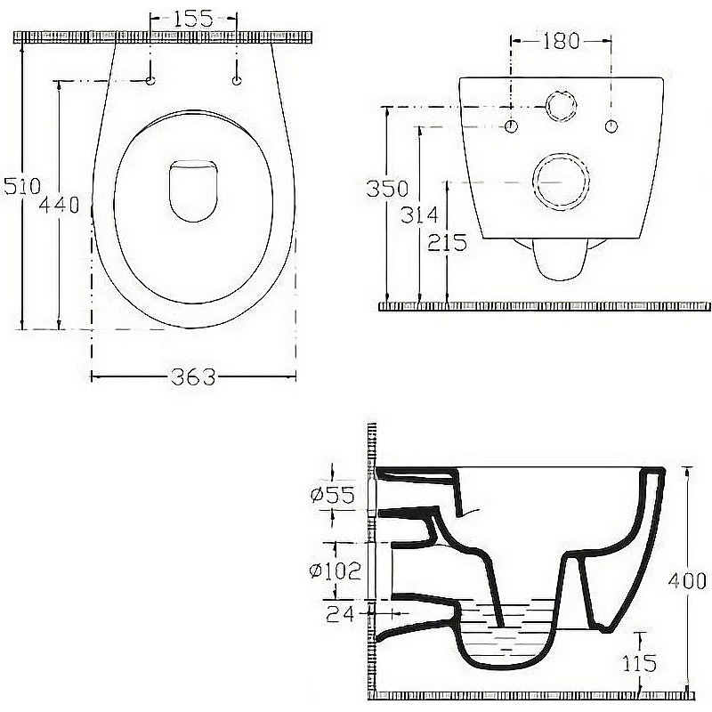 Унитаз Allen Brau Fantasy 4.11HC1.20 безободковый, с крышкой микролифт, белый купить в интернет-магазине Sanbest